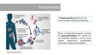A terapia genética poderá vir a ser
uma cura para a Doença de Gaucher.
Dá-se a introdução de genes normais
da glicocerebrosidase em células de
um indivíduo afetado, e assim, essas
células produziriam quantidades
suficientes de glicocerebrosidase.
Fig.15: Terapia Génica
 