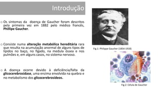 Introdução
o Os sintomas da doença de Gaucher foram descritos
pela primeira vez em 1882 pelo médico francês,
Phillipe Gaucher.
o Consiste numa alteração metabólica hereditária rara
que resulta na acumulação anormal de alguns tipos de
lípidos no baço, no fígado, na medula óssea e nos
pulmões e, em alguns casos, no sistema nervoso.
o A doença ocorre devido à deficiência/falta da
glicocerebrosidase, uma enzima envolvida na quebra e
no metabolismo dos glicocerebrosídeos.
Fig.1: Philippe Gaucher (1854-1918)
Fig.2: Célula de Gaucher
 