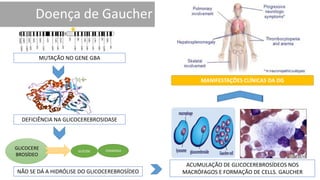 MUTAÇÃO NO GENE GBA
DEFICIÊNCIA NA GLICOCEREBROSIDASE
NÃO SE DÁ A HIDRÓLISE DO GLICOCEREBROSÍDEO
GLICOSE CERAMIDA
GLICOCERE
BROSÍDEO
ACUMULAÇÃO DE GLICOCEREBROSÍDEOS NOS
MACRÓFAGOS E FORMAÇÃO DE CELLS. GAUCHER
MANIFESTAÇÕES CLÍNICAS DA DG
 