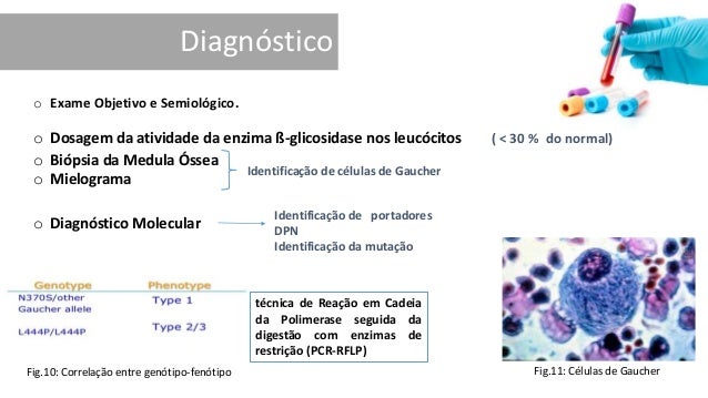 Exame mielograma
