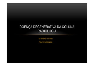 Dr Antenor Tavares
Neurorradiologista
DOENÇA DEGENERATIVA DA COLUNA
RADIOLOGIA
 
