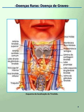  Sintomas ---------------------------------------------------- 7