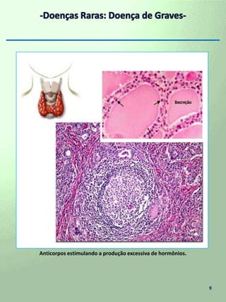  Posição da tireóide --------------------------------------- 8 