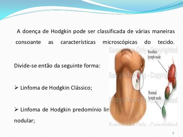 Doenca De Hodgkin