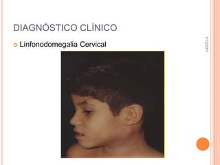 DIAGNÓSTICO CLÍNICO




                                1/12/2011
   Linfonodomegalia Cervical
 