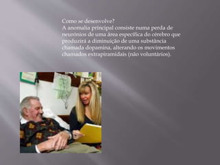 Como se desenvolve?
A anomalia principal consiste numa perda de
neurónios de uma área específica do cérebro que
produzirá a diminuição de uma substância
chamada dopamina, alterando os movimentos
chamados extrapiramidais (não voluntários).
 