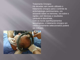 Tratamento Cirúrgico
Há décadas vem sendo utilizado o
tratamento cirúrgico para o controle da
sintomatologia parkinsoniana, ora
actuando sobre os tremores, ora sobre a
rigidez, com técnicas e resultados
variáveis e discutíveis.
Com os novos aperfeiçoamentos
tecnológicos, o tratamento cirúrgico em
casos sumamente seleccionados poderá
ser indicado.
 