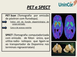 PET e SPECT
PET Scan (Tomografia por emissão
de pósitron com flurodopa).
   Índice útil da função dopaminérgica do
     corpo estriado.
   Cara e de acesso restrito.


SPECT (Tomografia computadorizada
com emissão de fóton único, que
utiliza radio- isótopos que ligam-se
ao transportador da Dopamina nos
terminais nigroestriatais)
 