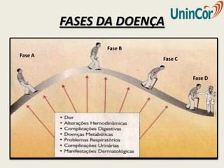 FASES DA DOENÇA
               Fase B
Fase A
                        Fase C


                                 Fase D
 