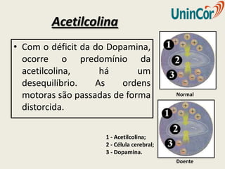 Acetilcolina
• Com o déficit da do Dopamina,
  ocorre o predomínio da
  acetilcolina,     há       um
  desequilíbrio.   As    ordens
  motoras são passadas de forma            Normal

  distorcida.

                    1 - Acetilcolina;
                    2 - Célula cerebral;
                    3 - Dopamina.
                                           Doente
 