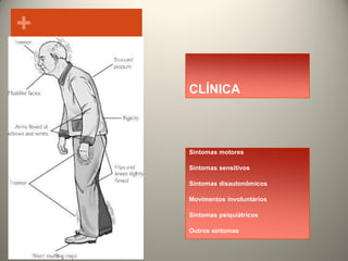 +
CLÍNICA

Sintomas motores
Sintomas sensitivos
Sintomas disautonômicos
Movimentos involuntários
Sintomas psiquiátricos
Outros sintomas

 
