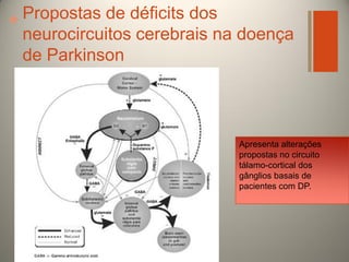 Propostas de déficits dos
+
neurocircuitos cerebrais na doença
de Parkinson

Apresenta alterações
propostas no circuito
tálamo-cortical dos
gânglios basais de
pacientes com DP.

 
