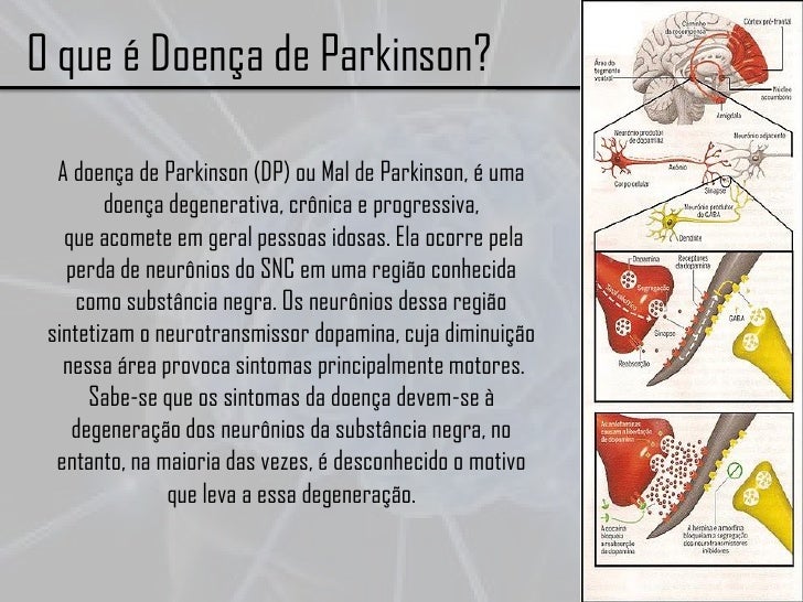 A Doença De Parkinson É Hereditária? – XPXVRE