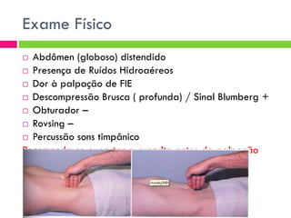 Exame Físico
Abdômen (globoso) distendido
 Presença de Ruídos Hidroaéreos
 Dor à palpação de FIE
 Descompressão Brusca ( profunda) / Sinal Blumberg +
 Obturador –
 Rovsing –
 Percussão sons timpânico
Recomenda-se executar a ausculta antes da palpação
para evitar aumento involuntário do peristaltismo.


 