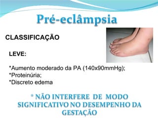 CLASSIFICAÇÃO LEVE: *Aumento moderado da PA (140x90mmHg); *Proteinúria; *Discreto edema 