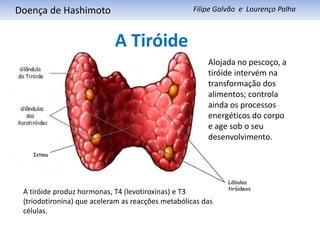      Doença de HashimotoFilipe Galvão  e  Lourenço PalhaA TiróideAlojada no pescoço, a tiróide intervém na transformação dos alimentos; controla ainda os processos energéticos do corpo e age sob o seu desenvolvimento.  IstmoLóbulos tiróideosA tiróide produz hormonas, T4 (levotiroxinas) e T3 (triodotironina) que aceleram as reacções metabólicas das células. 