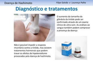 Diagnóstico e tratamentos     Doença de HashimotoFilipe Galvão  e  Lourenço PalhaO aumento do tamanho da glândula da tiróide pode ser confirmado através de um exame clínico de ultra-som. As análises ao sangue também podem comprovar a presença da doençaNão é possível impedir a resposta imunitária contra a tiróide, mas existem tratamentos hormonais que podem travar os efeitos do hipoteroidismo provocados pela doença de hashimoto.