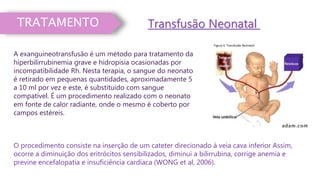 TRATAMENTO Transfusão Neonatal
A exanguineotransfusão é um método para tratamento da
hiperbilirrubinemia grave e hidropisia ocasionadas por
incompatibilidade Rh. Nesta terapia, o sangue do neonato
é retirado em pequenas quantidades, aproximadamente 5
a 10 ml por vez e este, é substituído com sangue
compatível. É um procedimento realizado com o neonato
em fonte de calor radiante, onde o mesmo é coberto por
campos estéreis.
O procedimento consiste na inserção de um cateter direcionado à veia cava inferior Assim,
ocorre a diminuição dos eritrócitos sensibilizados, diminui a bilirrubina, corrige anemia e
previne encefalopatia e insuficiência cardíaca (WONG et al, 2006).
Figura 4. Transfusão Neonatal
 