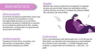 DIAGNÓSTICO
Doppler
Método não invasivo atualmente consagrado na avaliação
do grau de anemia fetal. Valores da velocidade sistólica
máxima (VSmáx) acima de 1,5 múltiplo da mediana (MoM)
são indicativos de anemia fetal.
Ultrassonografia
O aumento da espessura placentária (maior que
4 cm), perda de sua arquitetura e maior
homogeneidade parecem ser os primeiros
indicadores da doença. Polidrâmnio e aumento
da circunferência abdominal do feto, medida
seriadamente, correspondem ao agravamento
do processo hemolítico.
Cordocentese
Como o procedimento está relacionado com 1 a 2% de taxa de
óbito fetal, sua indicação está reservada para a eventualidade
de a VSmáx mostrar resultado > 1,5 MoM. Utilizado nesse
contexto, o sangue fetal com hematócrito < 30% (Hb < 10
g/dℓ)
Cardiotocografia
Traçados terminais (lisos, sinusoides, com
dips tardios) correspondem a fetos
gravemente atingidos por DHPN.
 