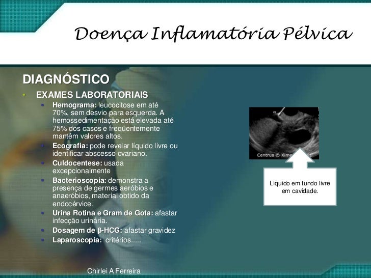 Exame pelvica