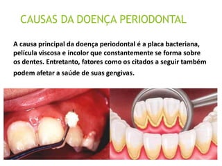 doença periodontal aula02.03.pptx
