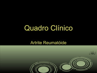 Quadro ClínicoQuadro Clínico
Artrite ReumatóideArtrite Reumatóide
 