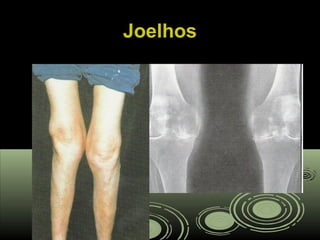 JoelhosJoelhos
 