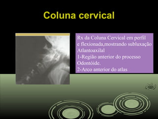 Coluna cervicalColuna cervical
Rx da Coluna Cervical em perfil
e flexionada,mostrando subluxação
Atlantoaxilal
1-Região anterior do processo
Odontóide.
2-Arco anterior do atlas
 