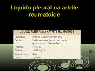 Líquido pleural na artriteLíquido pleural na artrite
reumatóidereumatóide
 