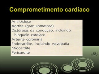 Comprometimento cardíacoComprometimento cardíaco
 