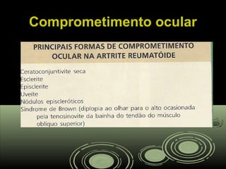 Comprometimento ocularComprometimento ocular
 
