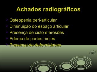 Achados radiográficosAchados radiográficos
 Osteopenia peri-articularOsteopenia peri-articular
 Diminuição do espaço articularDiminuição do espaço articular
 Presença de cisto e erosõesPresença de cisto e erosões
 Edema de partes molesEdema de partes moles
 Presença de deformidadesPresença de deformidades
 
