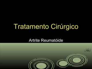 Tratamento CirúrgicoTratamento Cirúrgico
Artrite ReumatóideArtrite Reumatóide
 