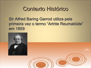 Contexto HistóricoContexto Histórico
 Sir Alfred Baring Garrod utiliza pelaSir Alfred Baring Garrod utiliza pela
primeira vez o termo “Artrite Reumatóide”primeira vez o termo “Artrite Reumatóide”
em 1859em 1859
 