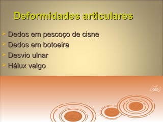 Deformidades articularesDeformidades articulares
 Dedos em pescoço de cisneDedos em pescoço de cisne
 Dedos em botoeiraDedos em botoeira
 Desvio ulnarDesvio ulnar
 Hálux valgoHálux valgo
 