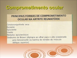 Comprometimento ocularComprometimento ocular
 
