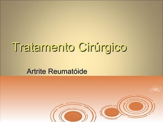 Tratamento CirúrgicoTratamento Cirúrgico
Artrite ReumatóideArtrite Reumatóide
 