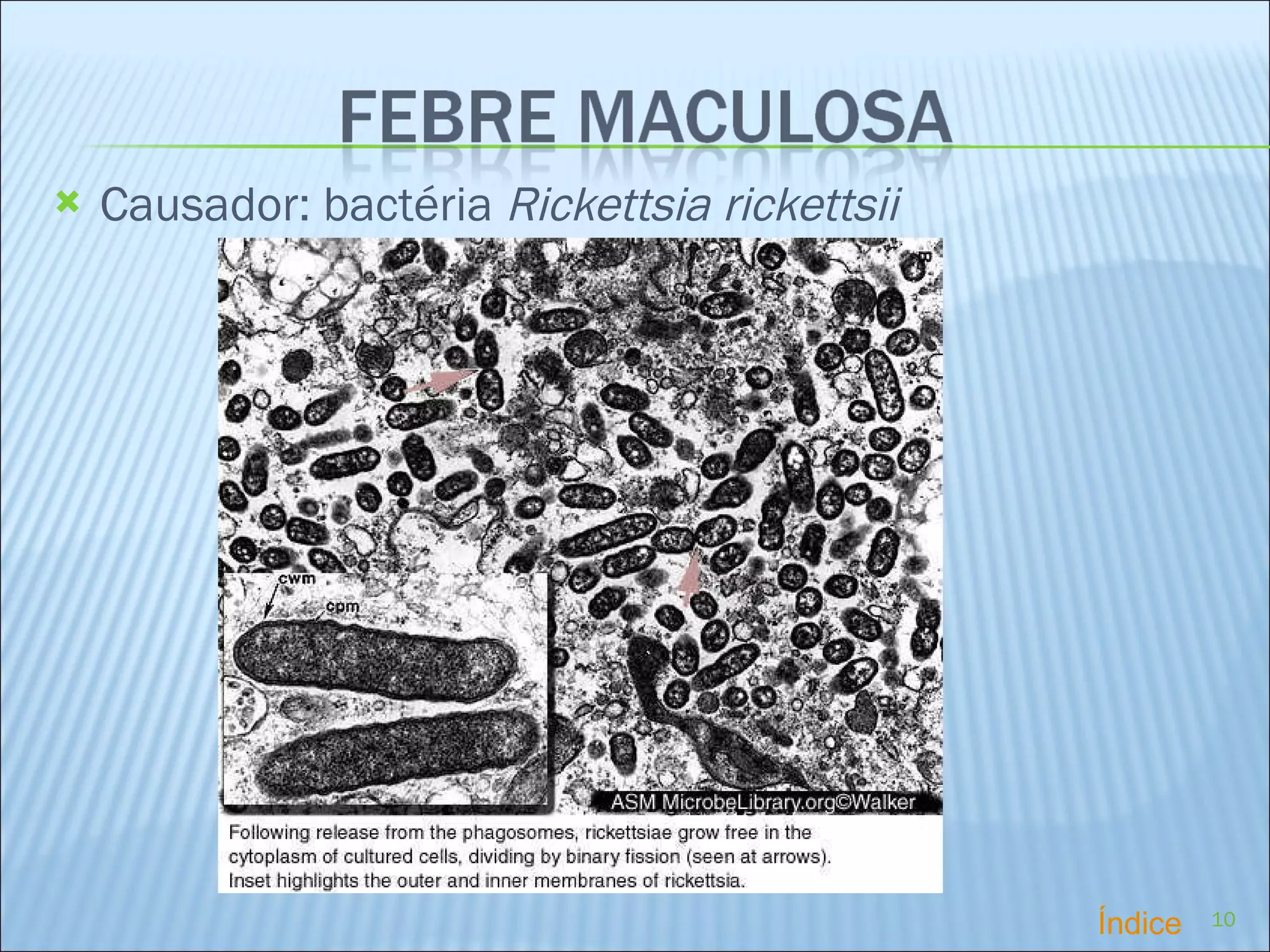 Causador:  bactéria  Rickettsia rickettsii Índice 