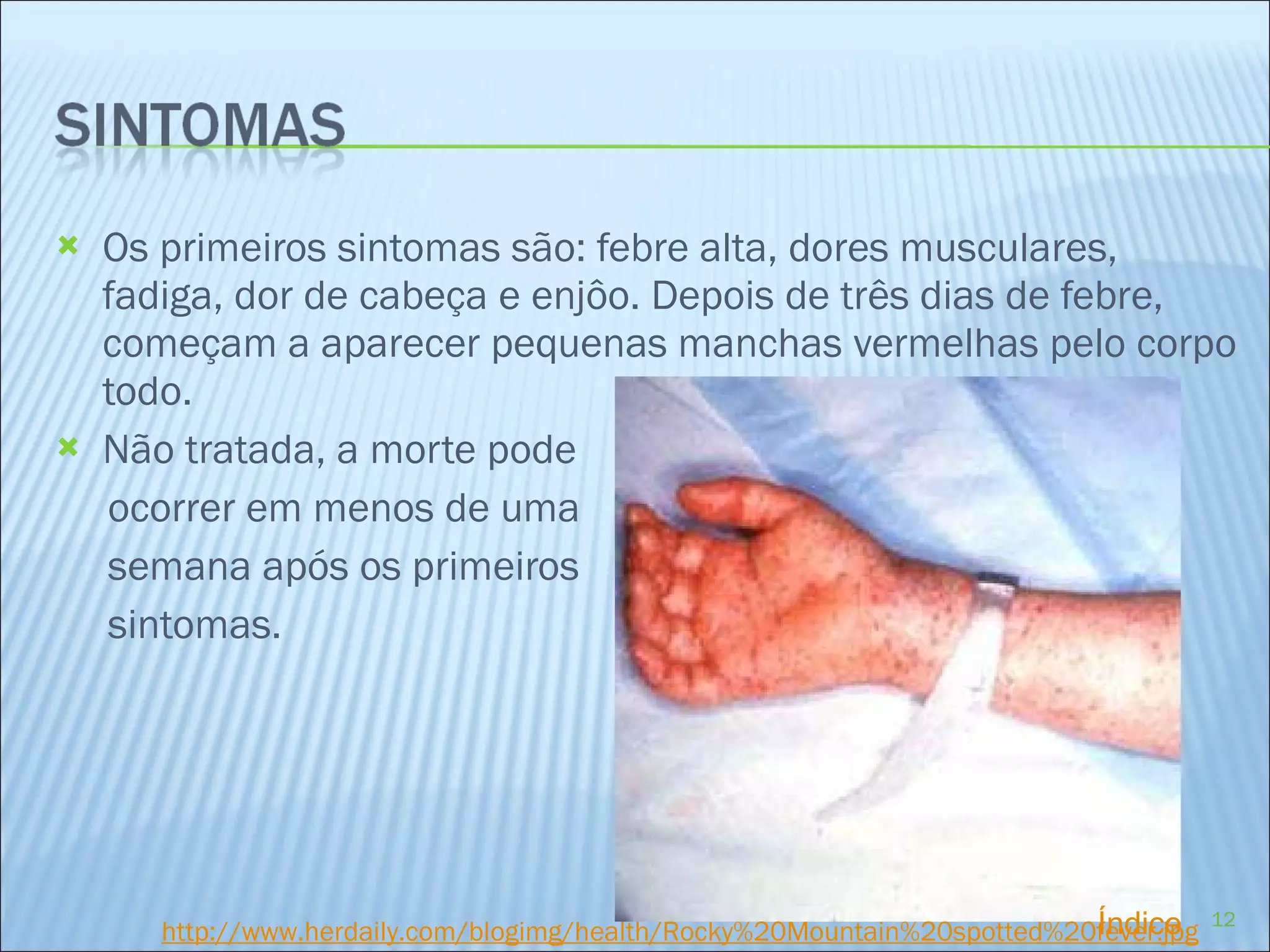 Os primeiros sintomas são: febre alta, dores musculares, fadiga, dor de cabeça e enjôo. Depois de três dias de febre, começam a aparecer pequenas manchas vermelhas pelo corpo todo. Não tratada, a morte pode  ocorrer em menos de uma semana após os primeiros  sintomas.   http://www.herdaily.com/blogimg/health/Rocky %20Mountain%20spotted%20fever. jpg Índice 