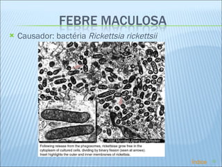 Causador:  bactéria  Rickettsia rickettsii Índice 