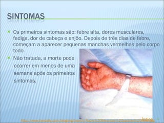 Os primeiros sintomas são: febre alta, dores musculares, fadiga, dor de cabeça e enjôo. Depois de três dias de febre, começam a aparecer pequenas manchas vermelhas pelo corpo todo. Não tratada, a morte pode  ocorrer em menos de uma semana após os primeiros  sintomas.   http://www.herdaily.com/blogimg/health/Rocky %20Mountain%20spotted%20fever. jpg Índice 