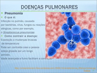 Pneumonia O que é: Infecção no pulmão, causada  por bactérias, vírus, fungos ou reações alérgicas, como por exemplo,  o  Streptococcus pneumoniae . Como contrair a doença: Exposição a mudanças bruscas de temperatura Pode ser contraída caso a pessoa  esteja gripada por um longo período. Idade avançada e fumo facilitam a contração   http://emssolutionsinc.files.wordpress.com/2009/10/streptococcus_20pneumoniae.jpg Índice 