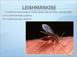 A Leishmaniose possui varios tipos,mas as mais comuns são: a) A Leishmaniose cutânea b) A Leishmaniose vísceral Índice 