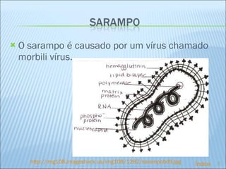 O sarampo é causado por um vírus chamado morbili vírus. http://img108.imageshack.us/img108/1292/sarampobd9.jpg Índice 