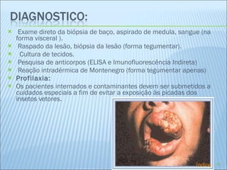 Exame direto da biópsia de baço, aspirado de medula, sangue (na forma visceral ). Raspado da lesão, biópsia da lesão (forma tegumentar).    Cultura de tecidos. Pesquisa de anticorpos (ELISA e Imunofluorescência Indireta) Reação intradérmica de Montenegro (forma tegumentar apenas) Profilaxia: Os pacientes internados e contaminantes devem ser submetidos a cuidados especiais a fim de evitar a exposição às picadas dos insetos vetores. Índice 