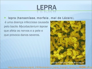   lepra  ( hanseníase ,  morfeia  ,  mal de Lázaro ), é uma doença infecciosa causada  pelo bacilo  Mycobacterium leprae  que afeta os nervos e a pele e  que provoca danos severos. http://www.ciriscience.org/ph_130-Mycobacterium_leprae_Copyright_Dennis_Kunkel_Microscopy Índice 