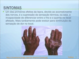 Um dos primeiros efeitos da lepra, devido ao acometimento dos nervos, é a supressão da sensação térmica, ou seja, a incapacidade de diferenciar entre o frio e o quente no local afetado. Mais tardiamente pode evoluir para diminuição da sensação de dor no local. http://louletania.blogs.sapo.pt/arquivo/Lepra.jpg Índice 