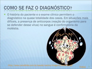O história do paciente e o exame clínico permitem o diagnóstico na quase totalidade dos casos. Em situações mais difíceis, a presença de anticorpos (reação do organismo para se defender desse vírus) no sangue é confirmatória da moléstia. http://www.canalkids.com.br/saude/vacina/imagens/sarampo.gif Índice 