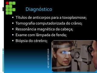  Títulos de anticorpos para a toxoplasmose;
 Tomografia computadorizada do crânio;
 Ressonância magnética da cabeça;
 Exame com lâmpada de fenda;
 Biópsia do cérebro;
www.saude.com.br
Diagnóstico
 