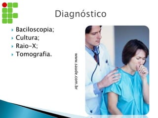  Baciloscopia;
 Cultura;
 Raio-X;
 Tomografia.
www.saude.com.br
 